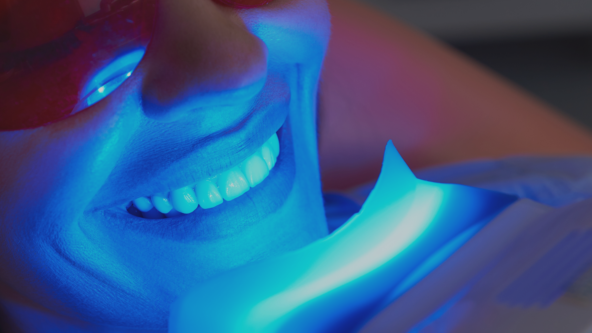 A Guide to Whitening Teeth Without Sensitivity