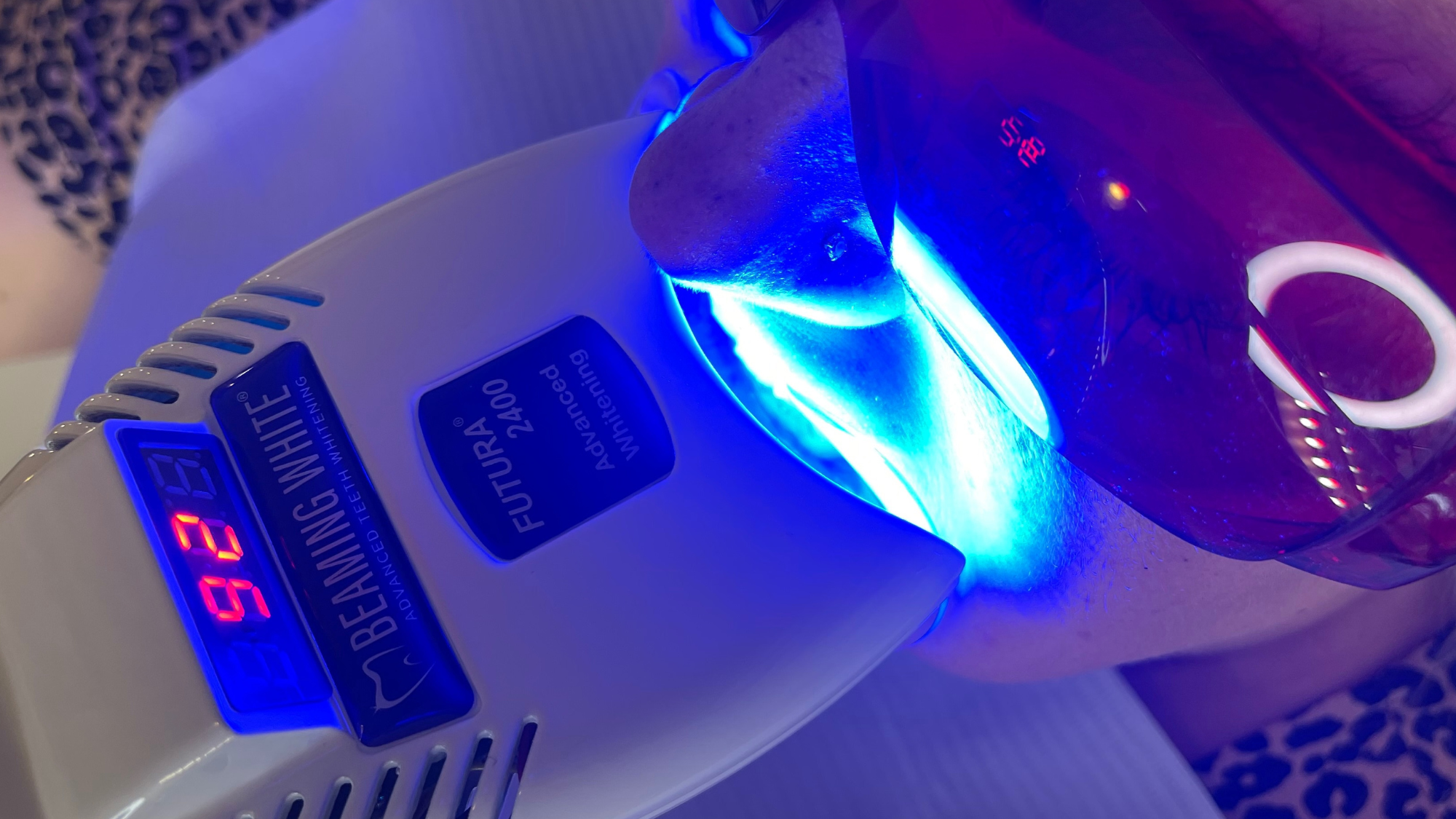 A Guide to Whitening Teeth Without Sensitivity