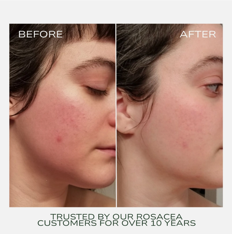 Redness Rescue Cream - 45ml2.png