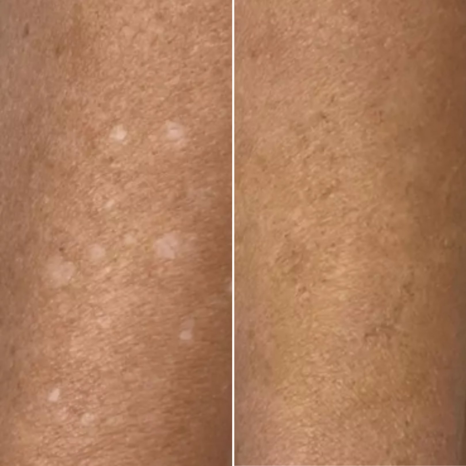 Skintone Camouflage Before and After (1).png