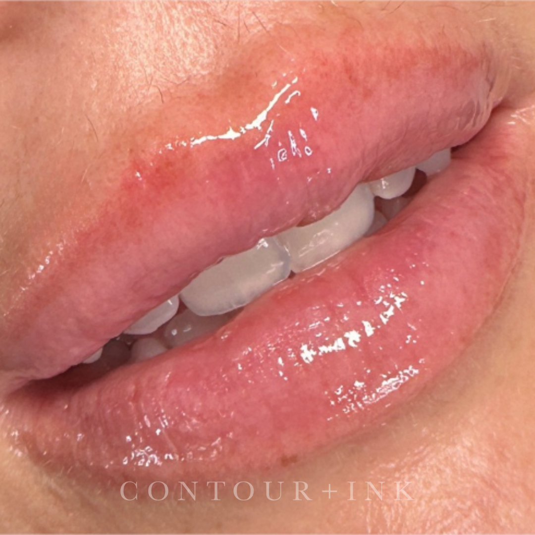 Close-up of a person's mouth with a small amount of saliva on the lips and teeth visible inside.