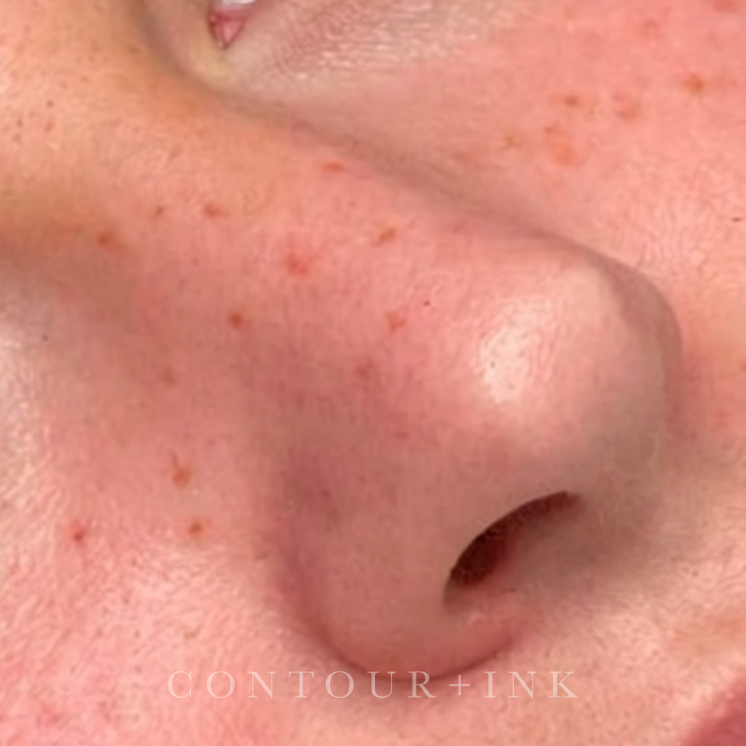 Close-up of a person's face, showing a part of supernatural freckles