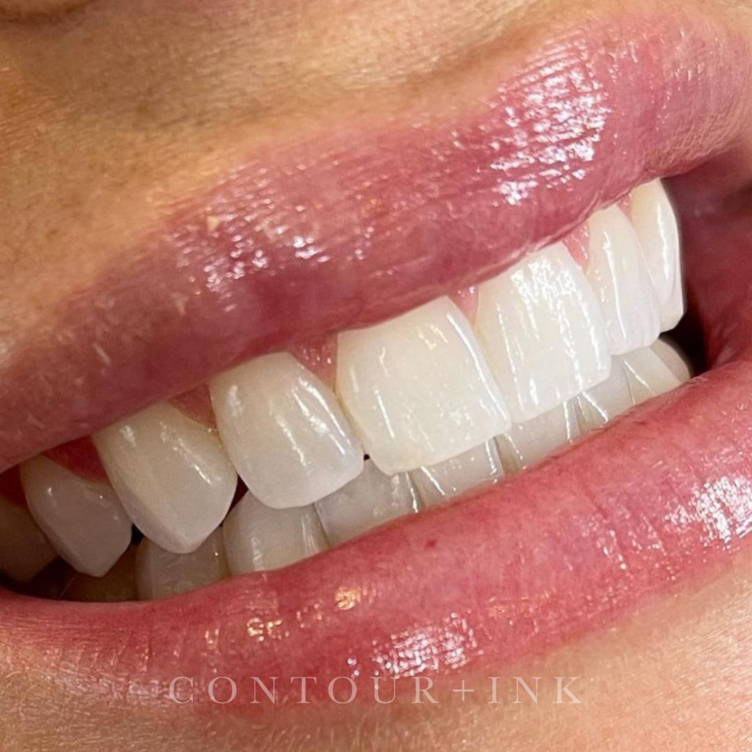 Close-up of a person's lips and teeth, showing the upper teeth with visible gums and pink lips with natural texture.