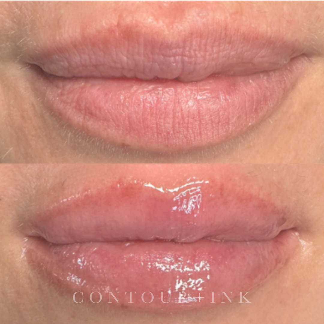 Close-up of two pairs of lips, displaying a before-and-after comparison of lip gloss application. The top lips are bare, while the bottom lips are shiny with gloss.
