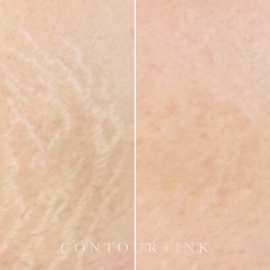 Comparison of skin texture, showing a before and after skincare treatment with a smoother skin appearance on the right.