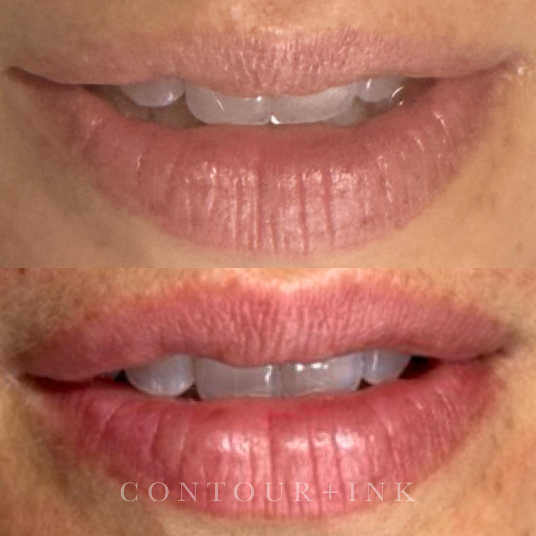 Close-up of human lips with markings and annotations for makeup or cosmetic procedures, showing upper and lower lips with natural color and textures.
