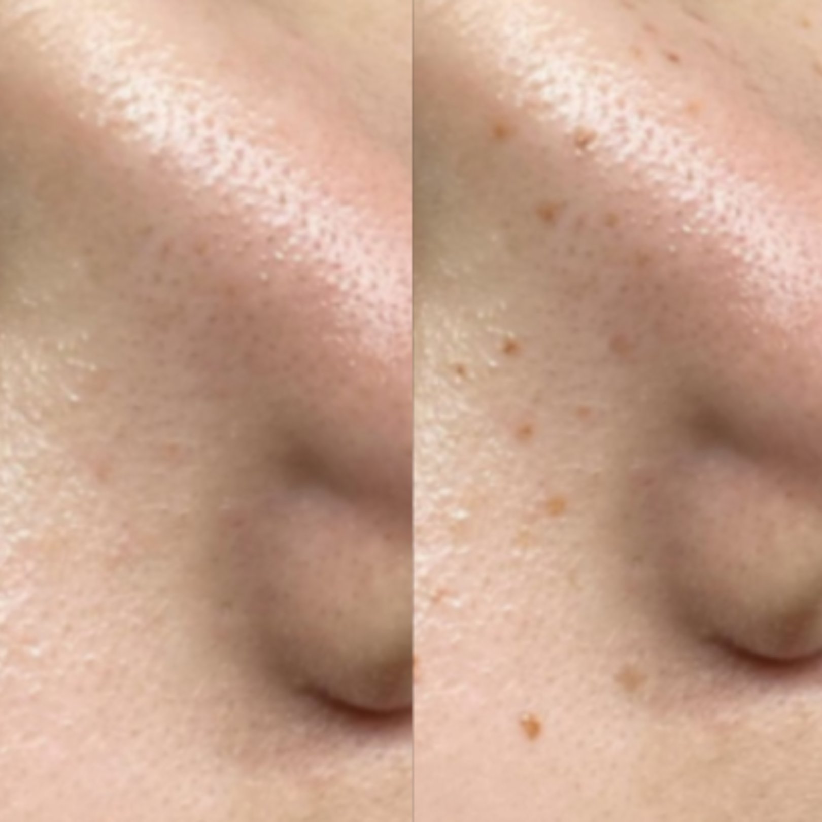 Supernatural Freckles Before and After (1).png