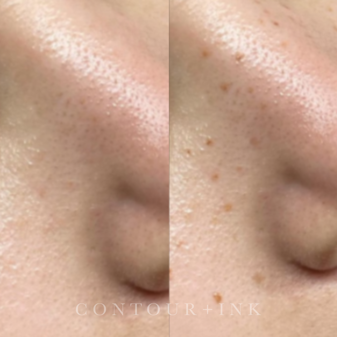 Close-up of human skin showing pores and small moles.