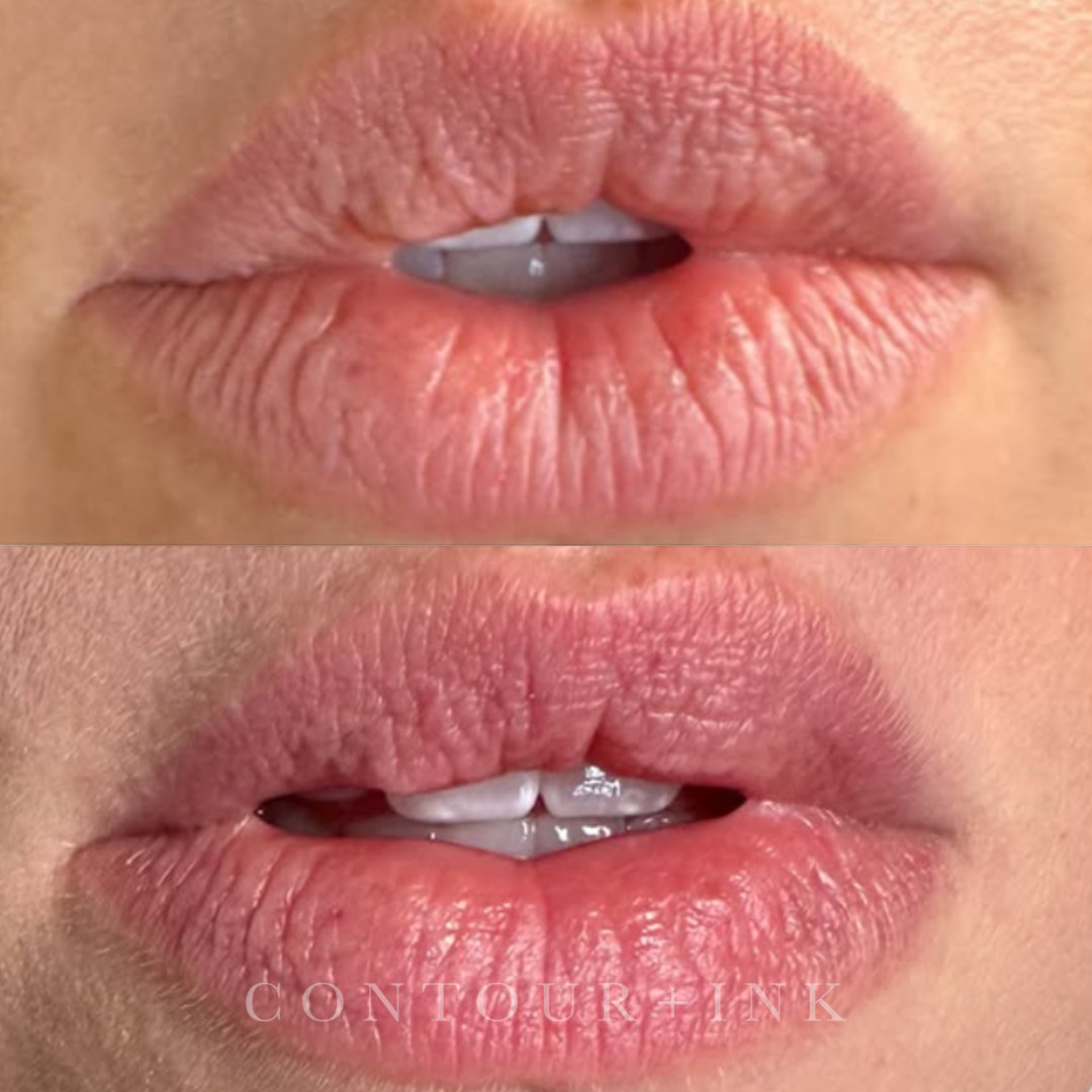 A close-up of a person's lips, showing two different images; the top image shows slightly parted lips with visible teeth and slightly chapped skin, while the bottom image shows the same lips with a moist, shiny finish and a more relaxed expression.