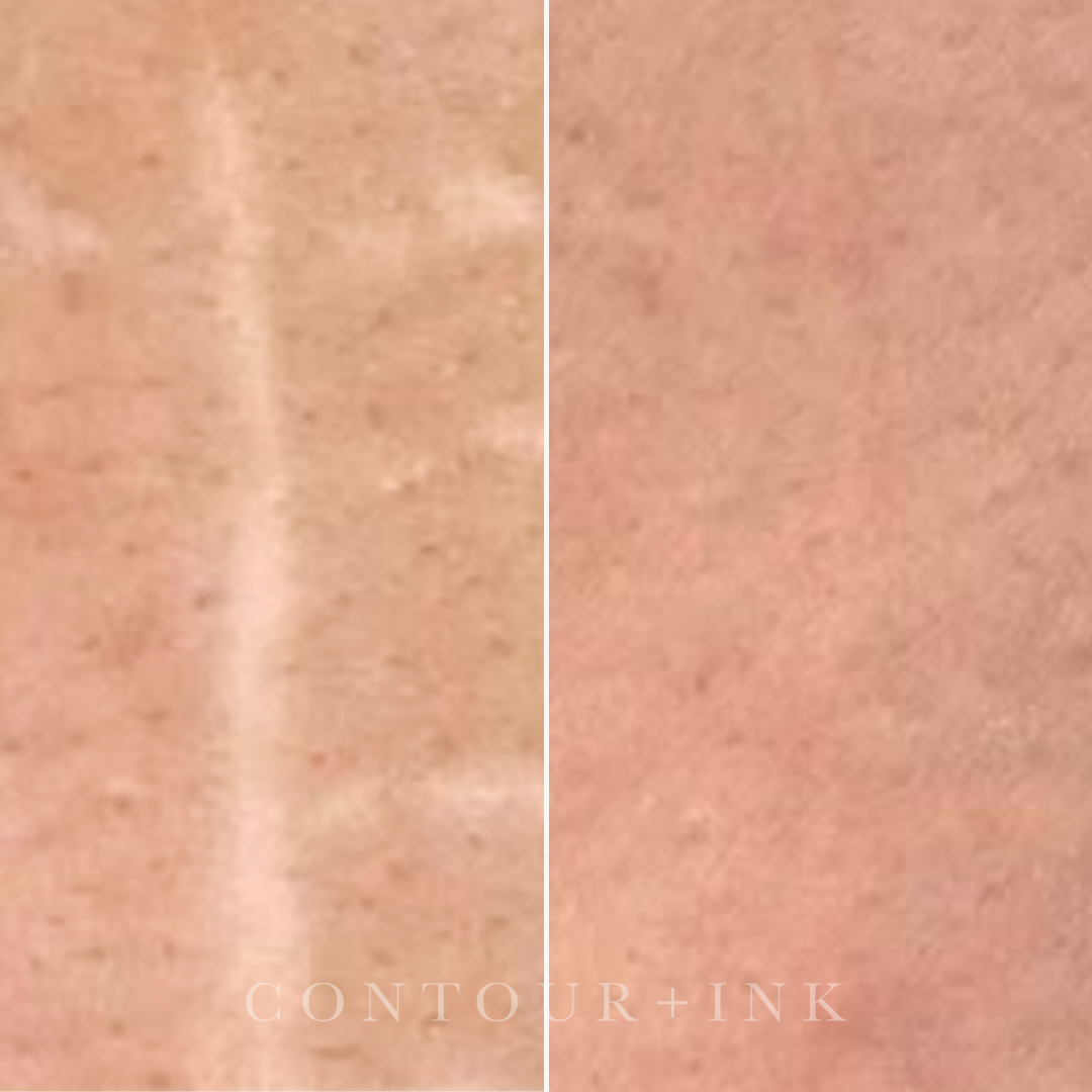 Comparison of skin surface before and after treatment showing reduced visible pigmentation or blemishes.