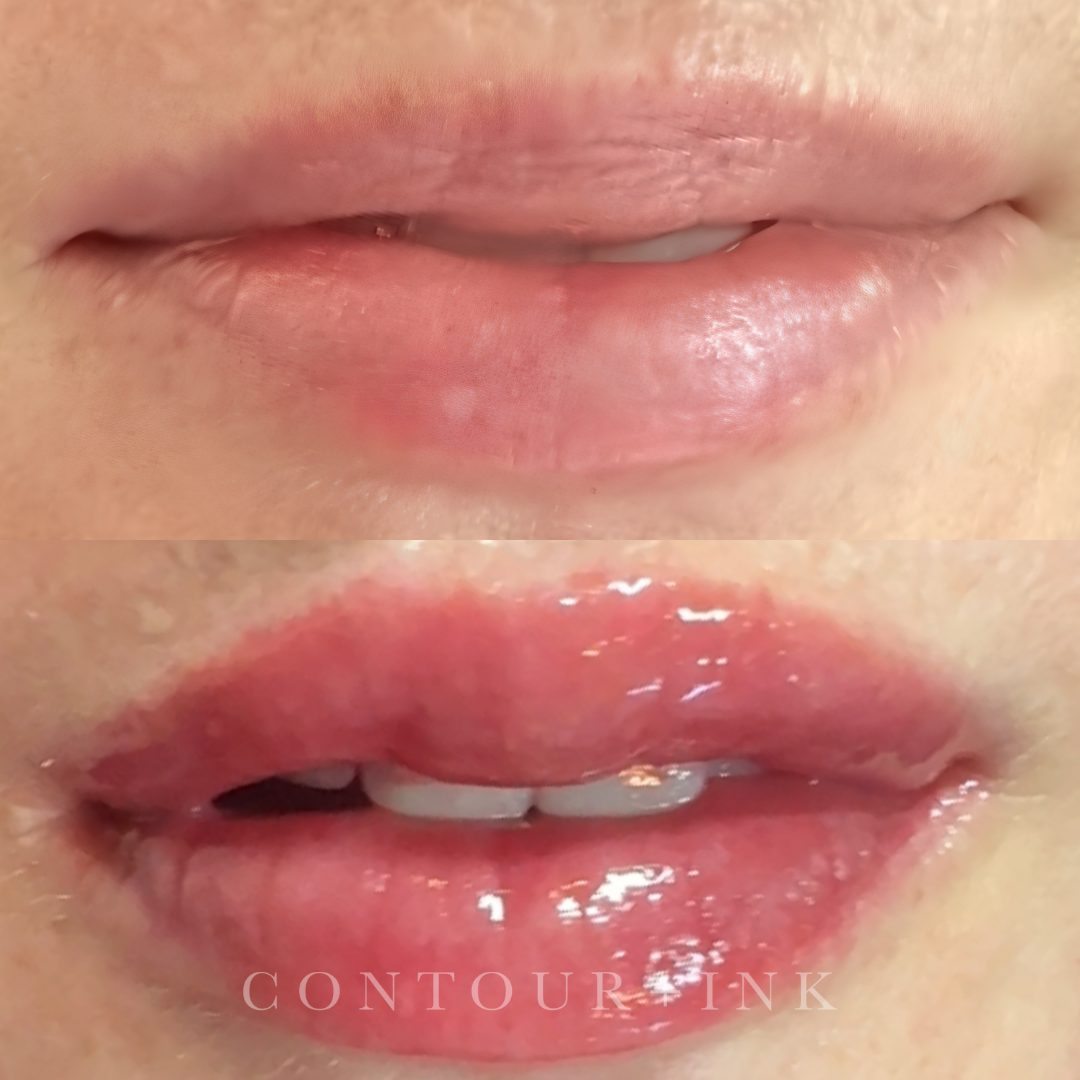 Close-up of a person's lips and teeth with the mouth slightly open, showing upper and lower teeth.
