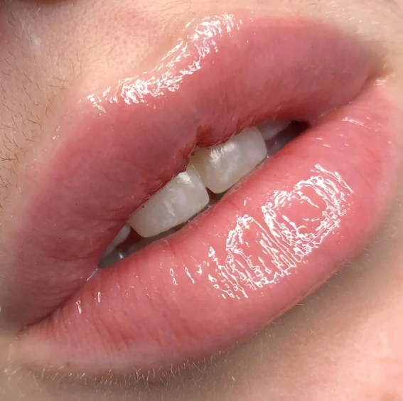 Close-up of lips and teeth, with the lips slightly parted.