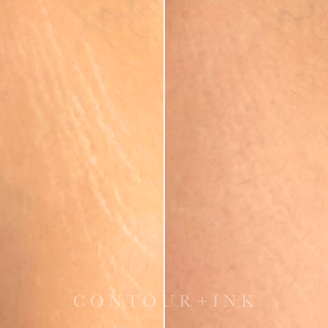 Close-up of skin texture, showing small pores and tiny reddish spots.