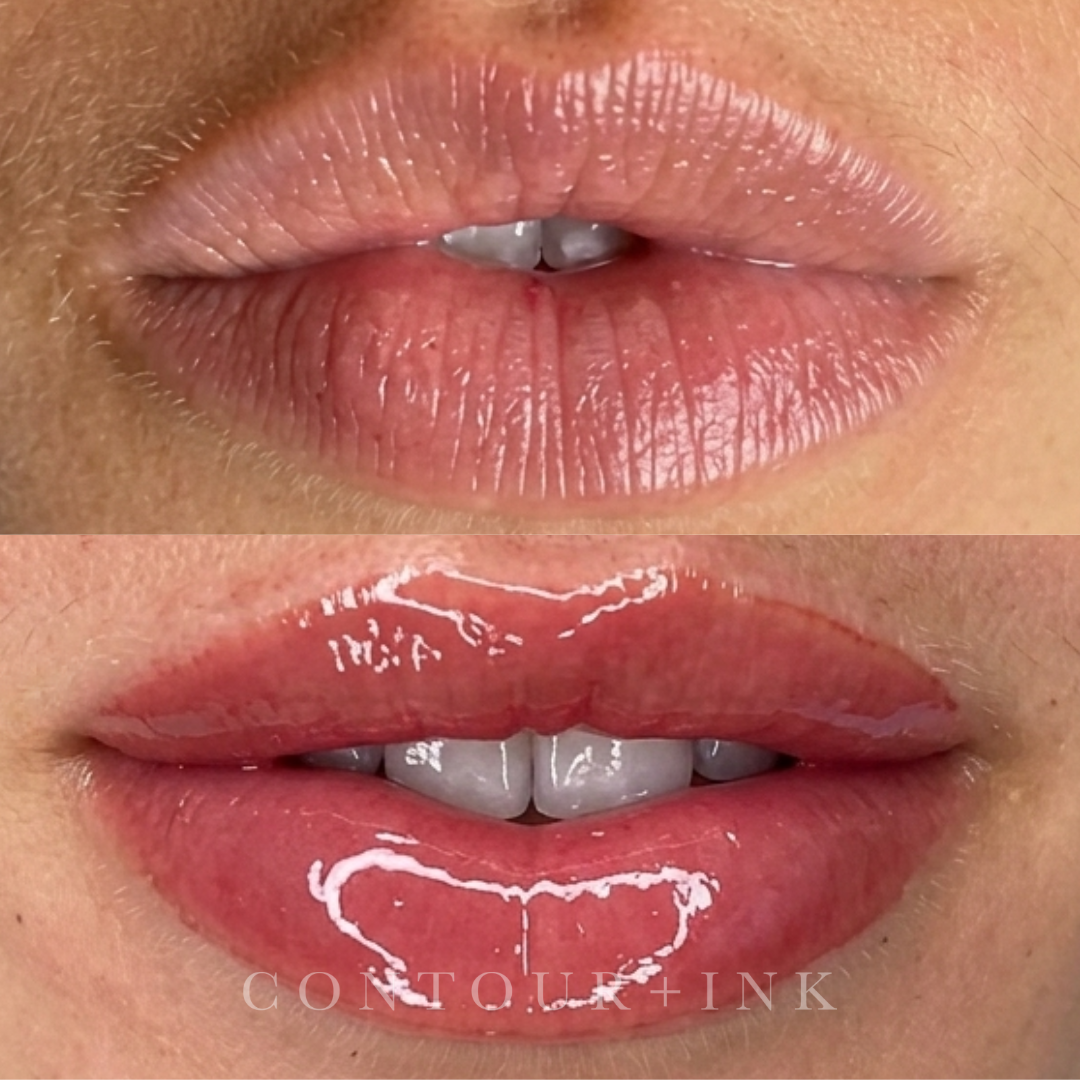 Close-up of a person's lips and nose, showing two different views with detailed skin texture and natural coloration.
