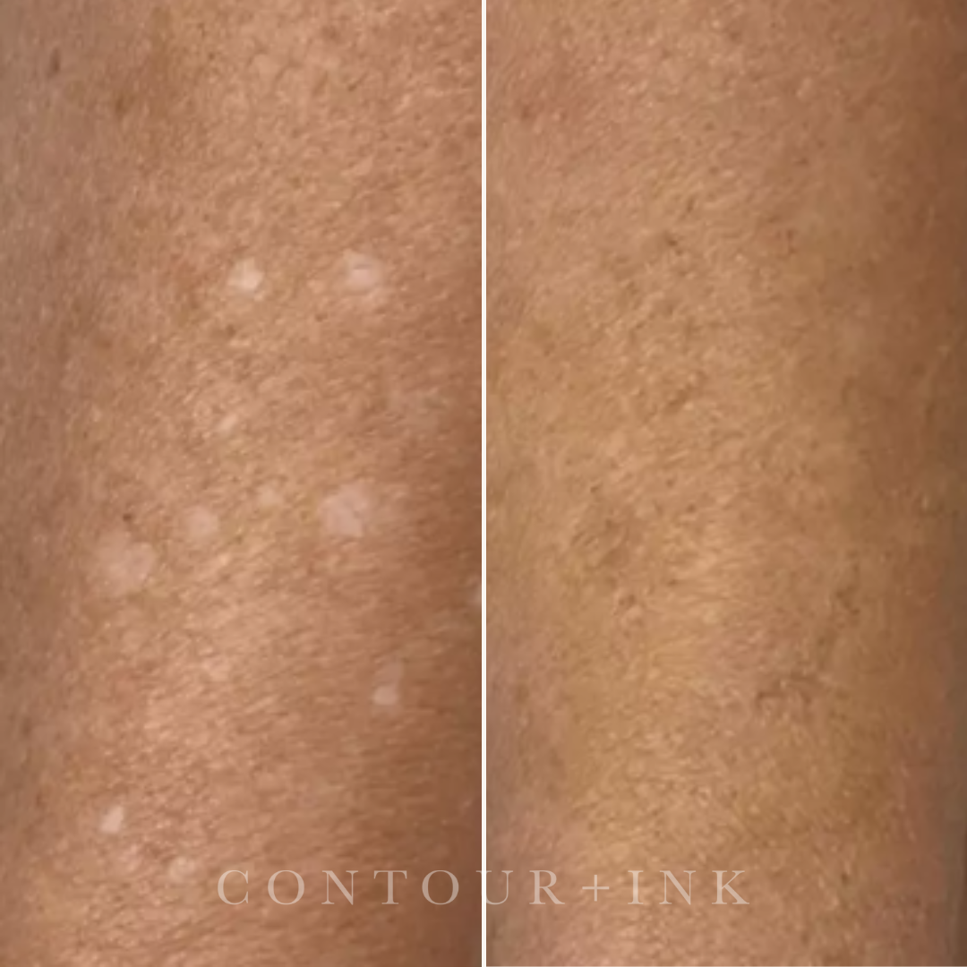 Close-up of a person's skin showing a comparison of the skin before and after treatment or skincare routine, with visible improvement on the right side.