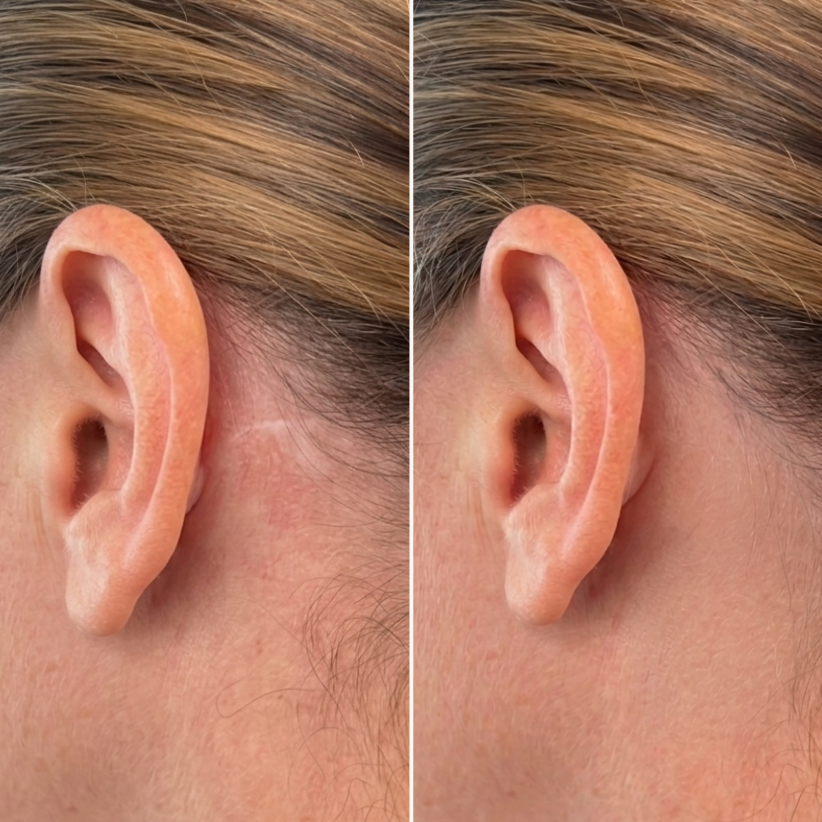 Skintone Camouflage Before and After (2).png
