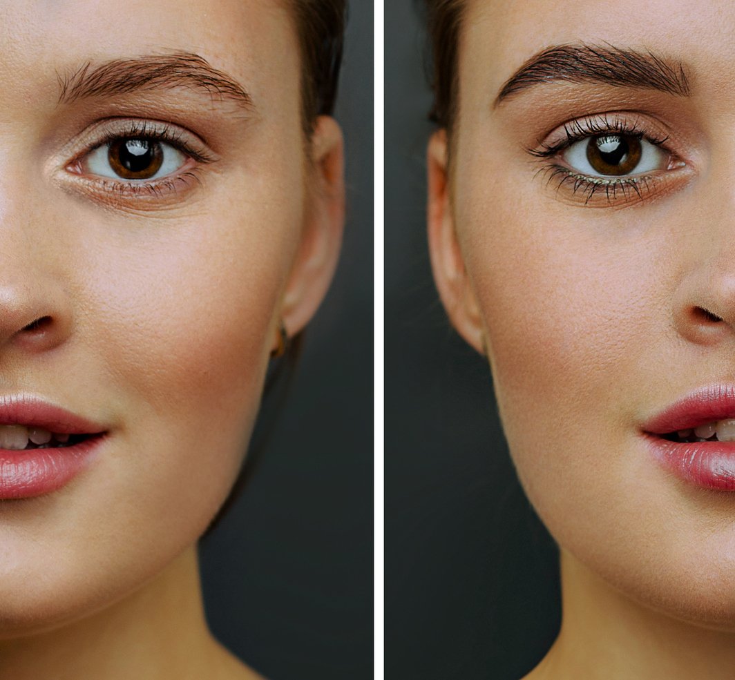 Looking for Brow Lamination in Chicago? Achieve perfectly groomed, fuller brows with our brow lamination service. This non-invasive treatment smooths, sets, and shapes your natural brow hairs for a fuller, more defined look that lasts up to 6-8 weeks