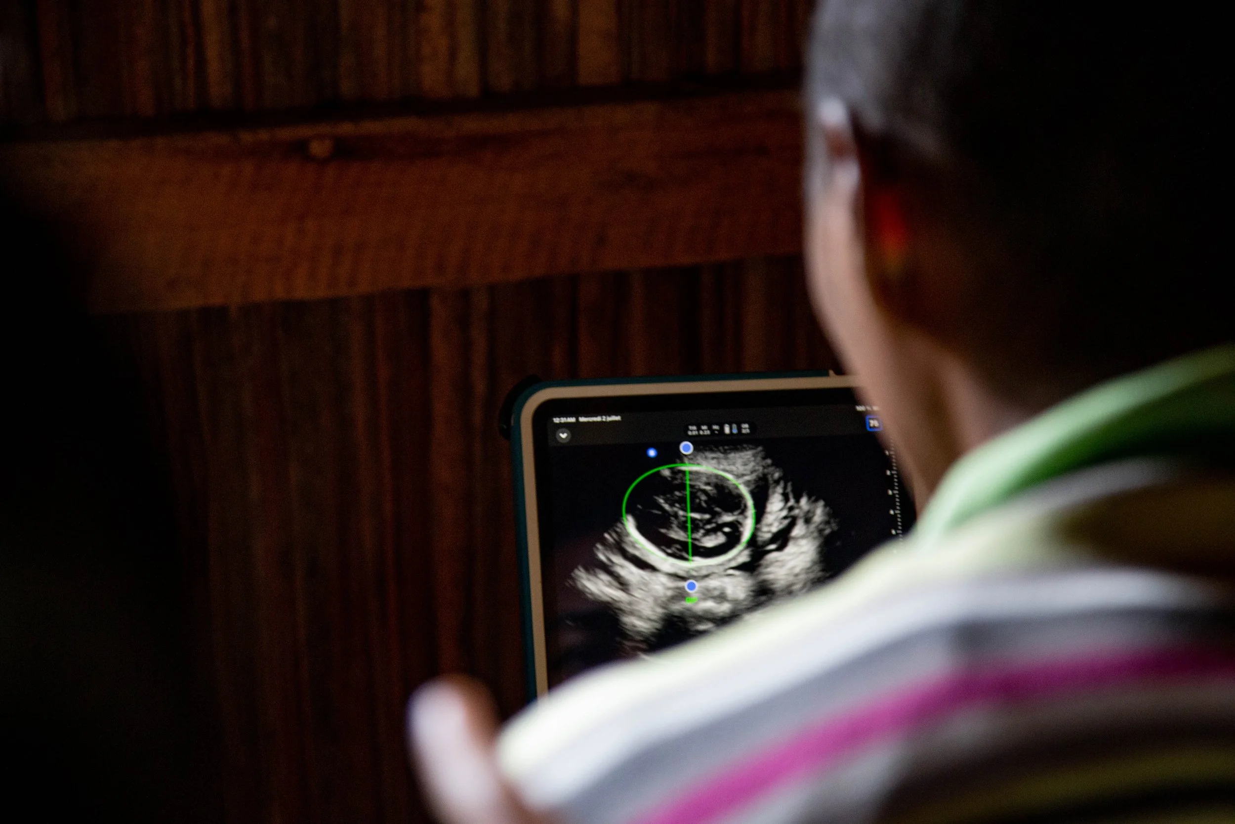 ultrasound in screen