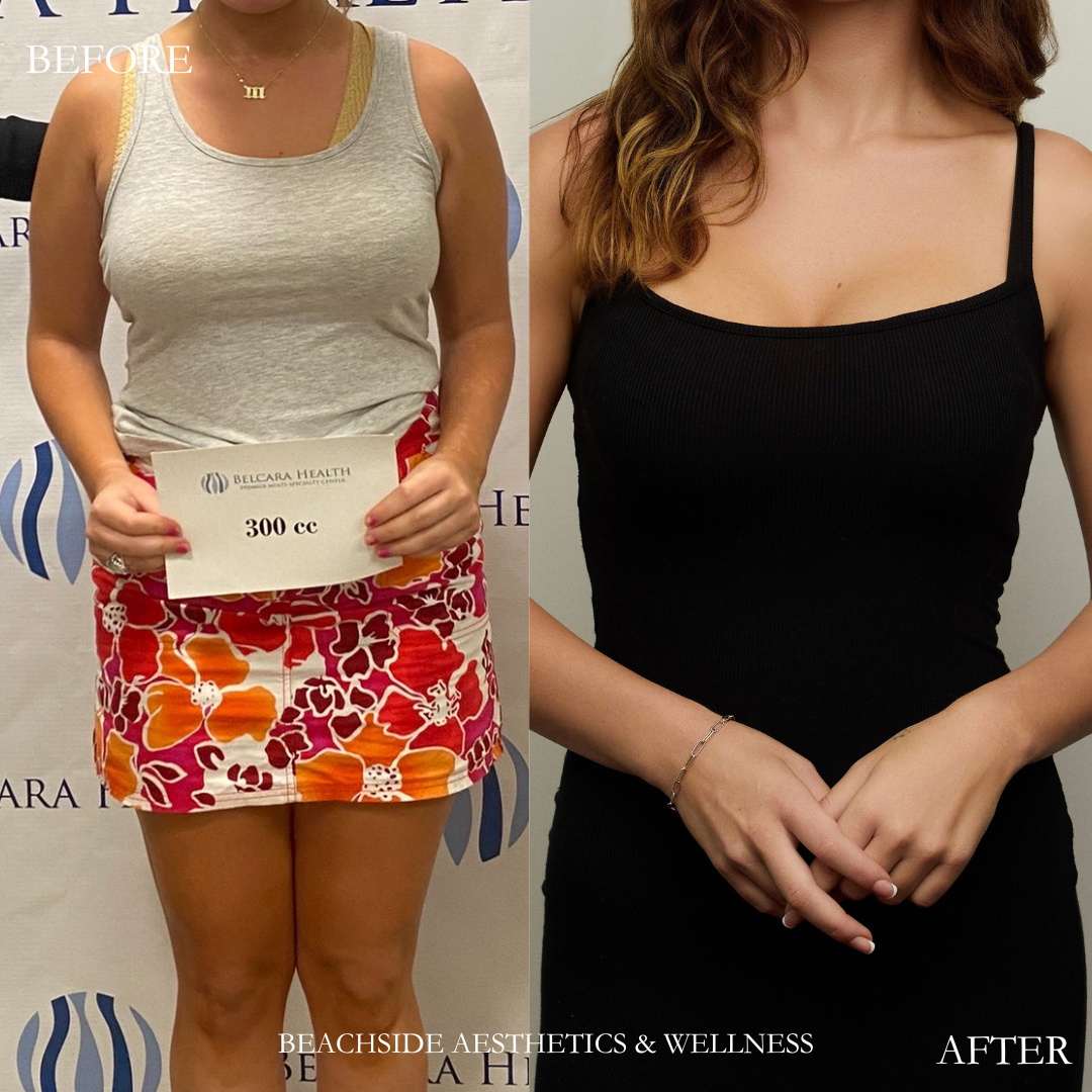 Before + After Instagram Post 2.png.PNG