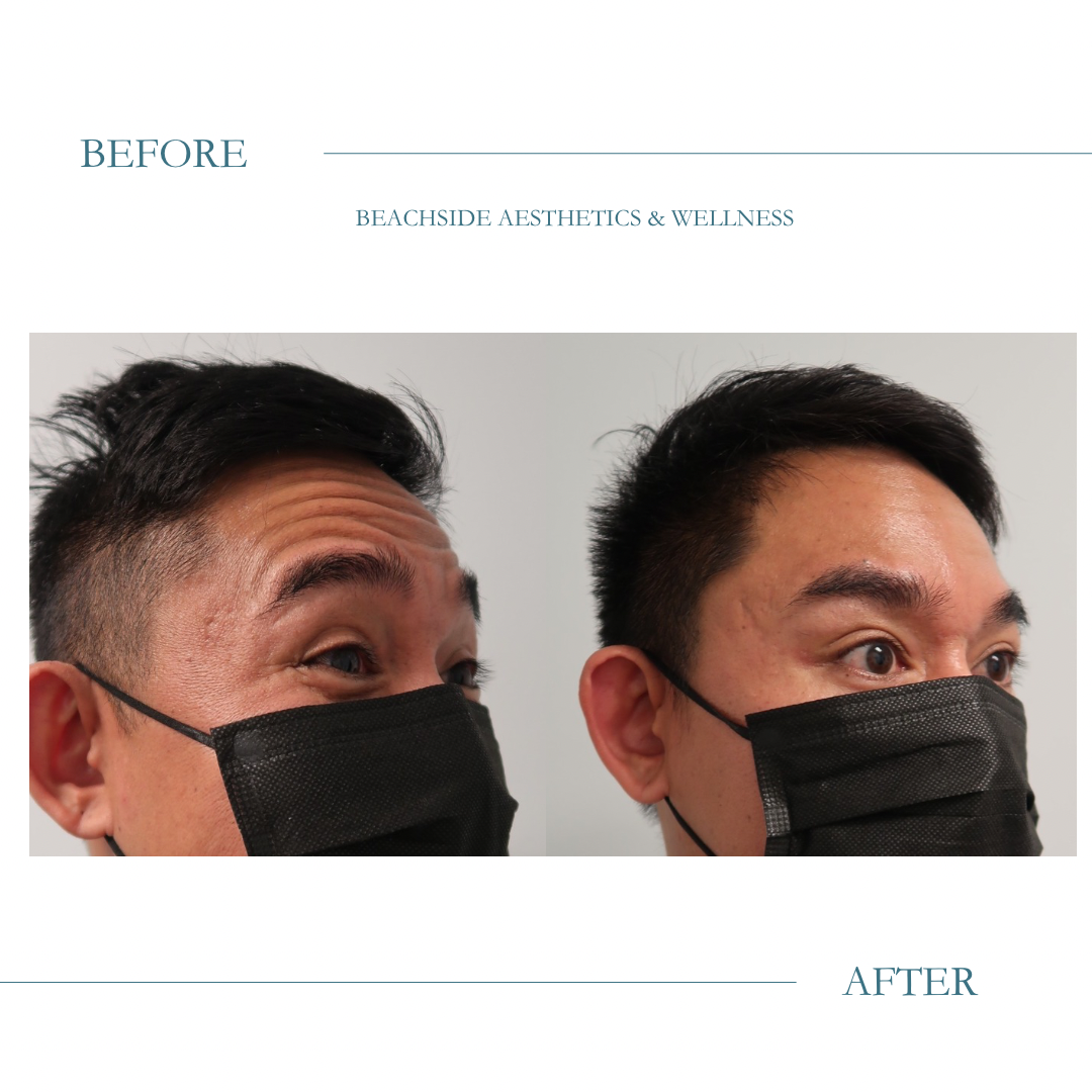 Before + After Instagram Post.PNG