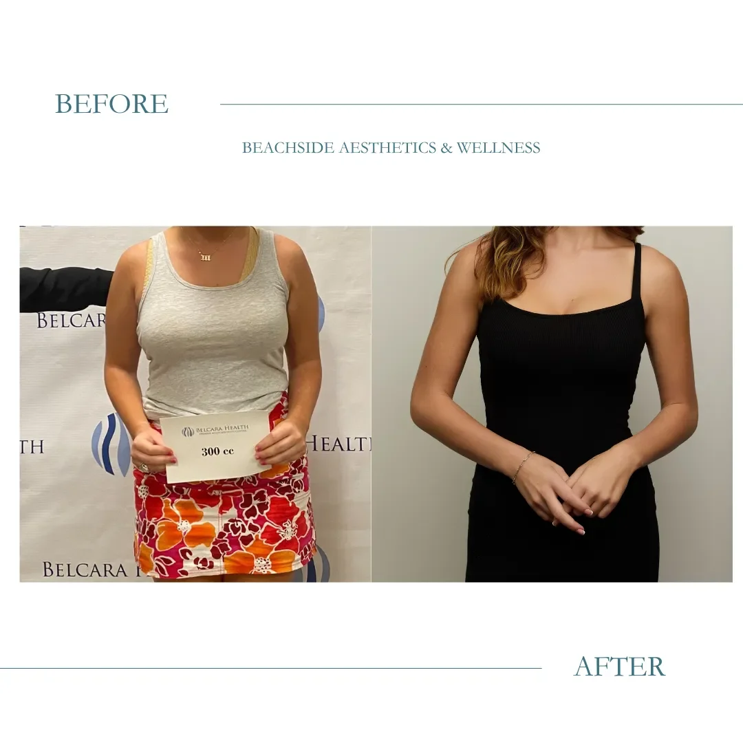 weight-loss-before-after-honolulu.webp