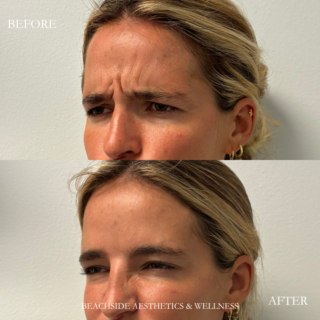 Best med spa for treatment of elevens with botox in Honolulu