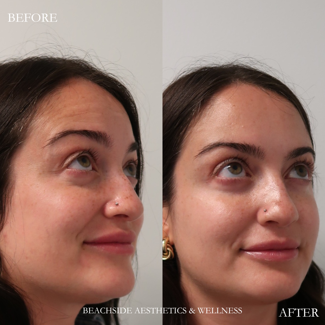 Results showing best med spa to get botox in Honolulu