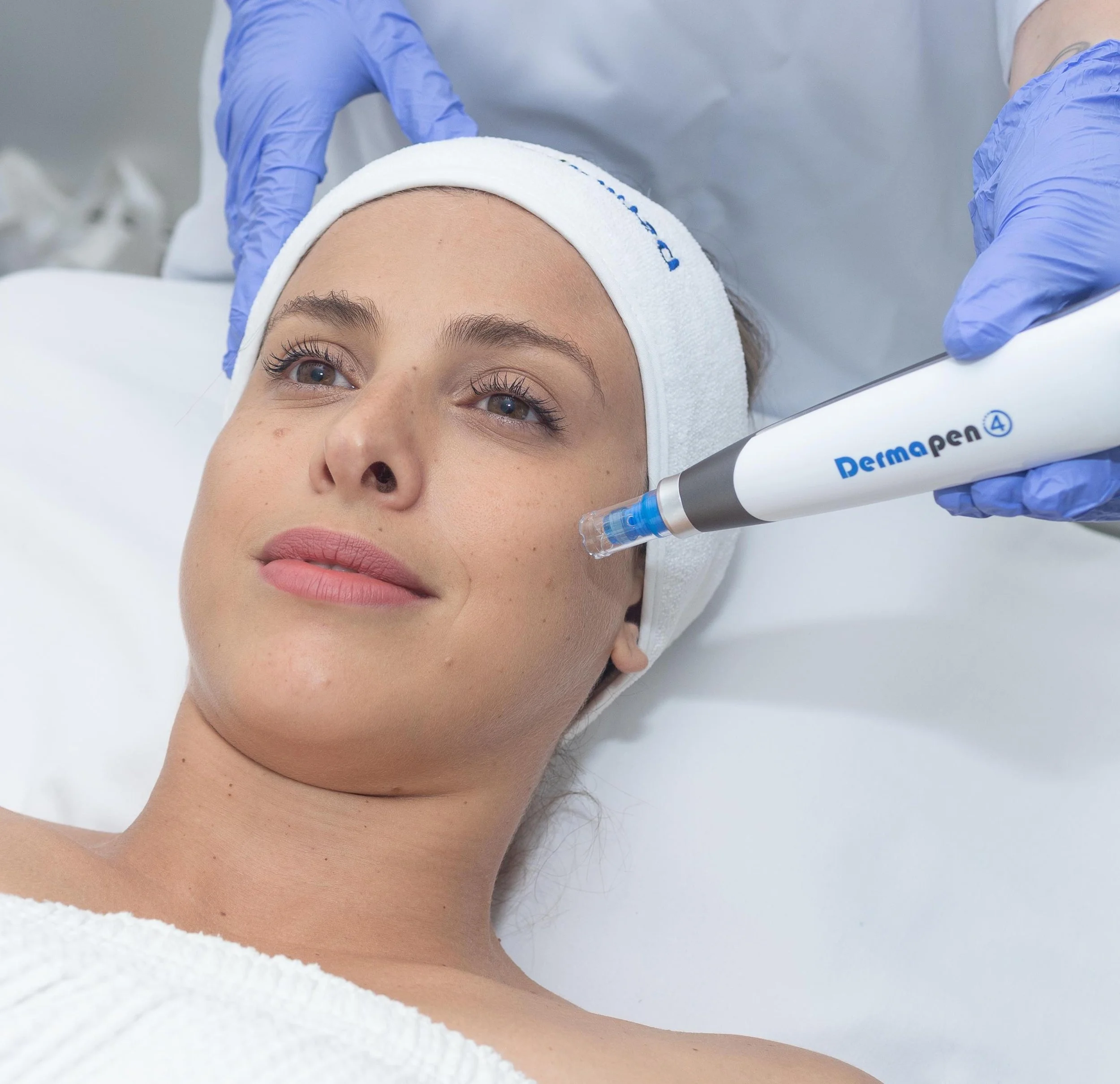 Dermapen 4.jpg