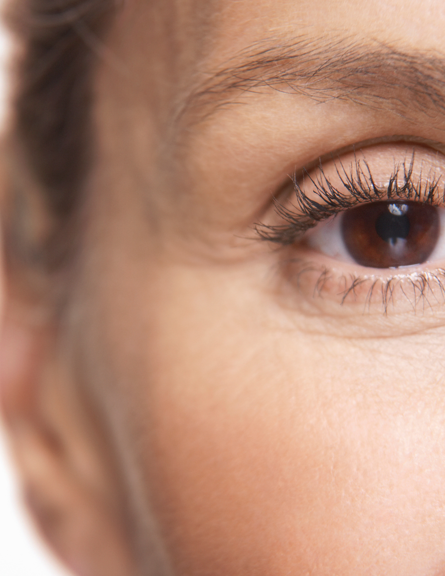 Crow’s feet injection treatment