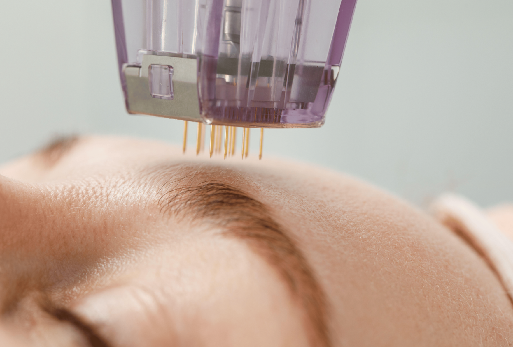 morpheus8 microneedling glastonbury,ct