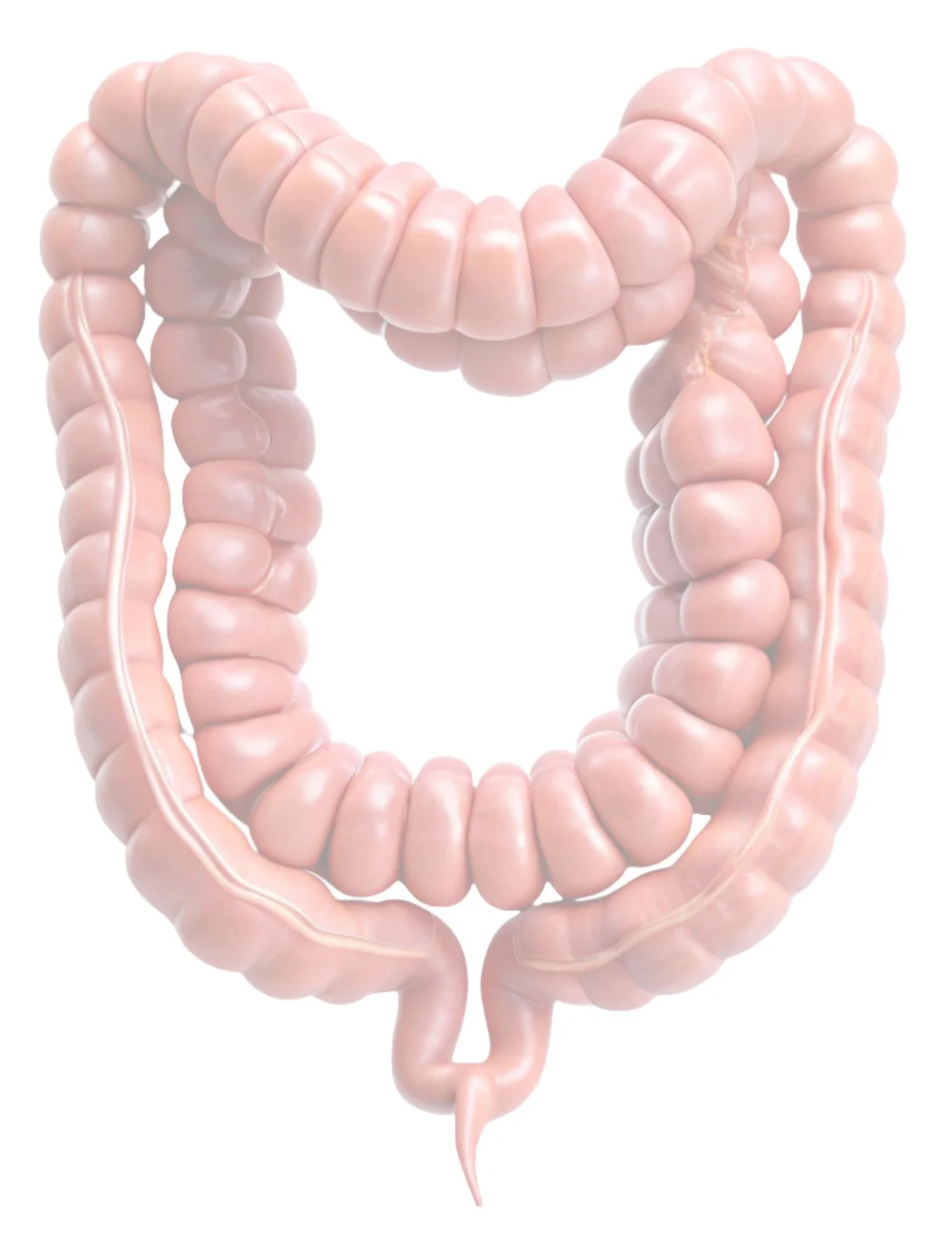 Appendix Endometriosis — The Center for Endometriosis Care