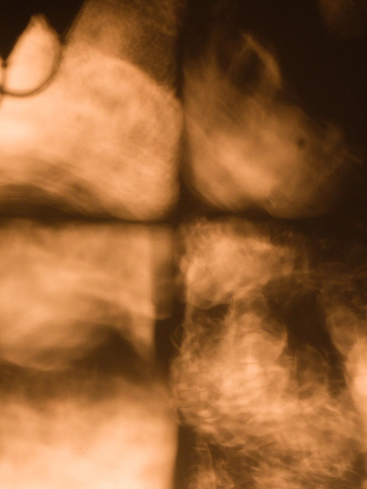 Caustic glass effects and window shadows playing over an interior wall.