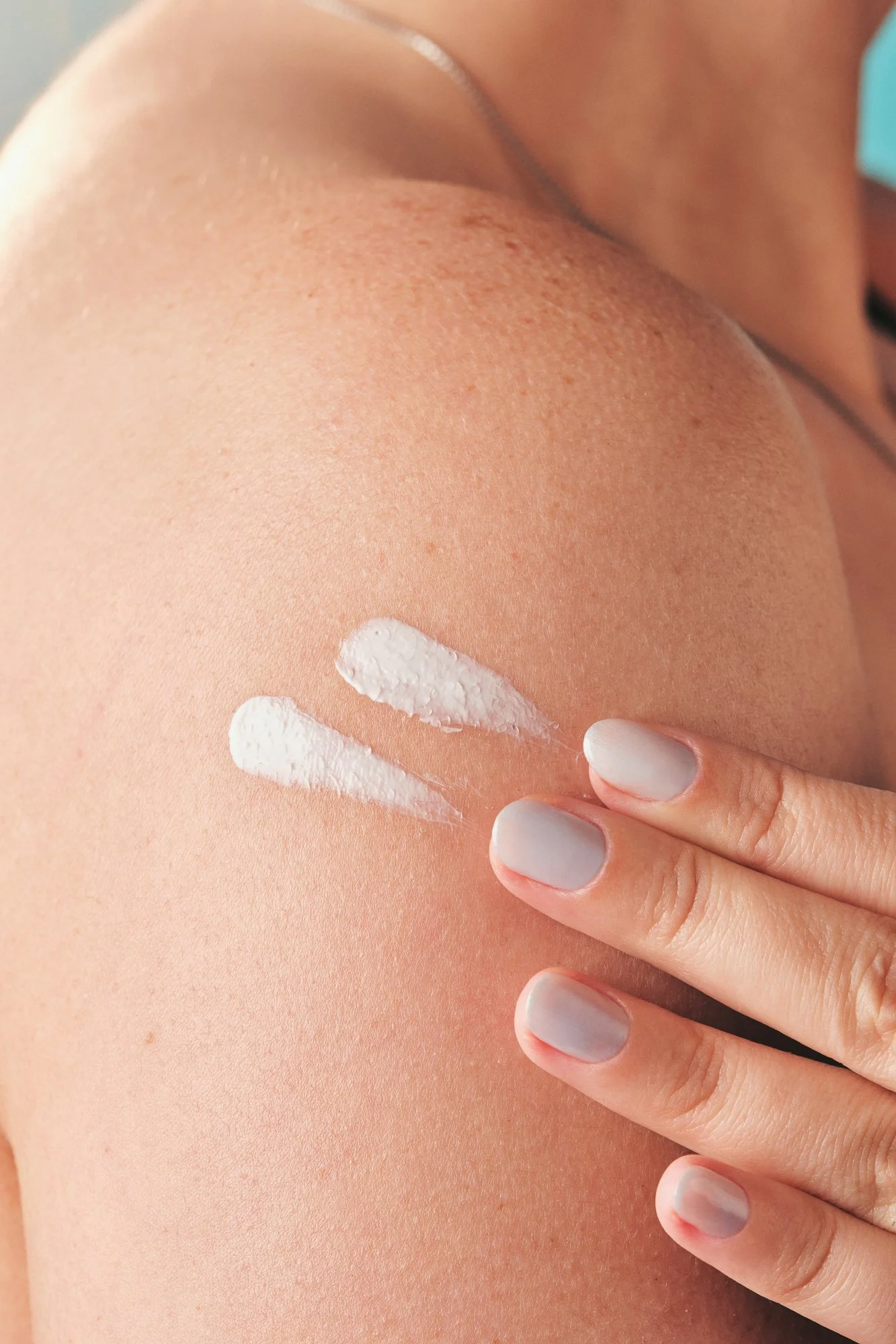Pessoa aplicando protetor solar na pele do braço.