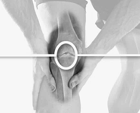 Optimizing Knee Pain 