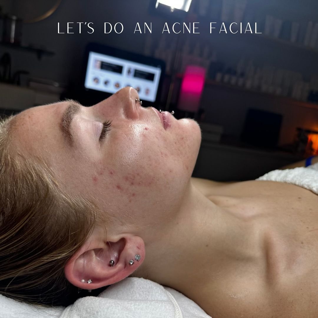 let&rsquo;s do a facial 😌

Face Reality treatments are good for everyone, wether you struggle from acne, pigmentation congestion, dullness or signs of aging we can customize a treatment for you 🪄