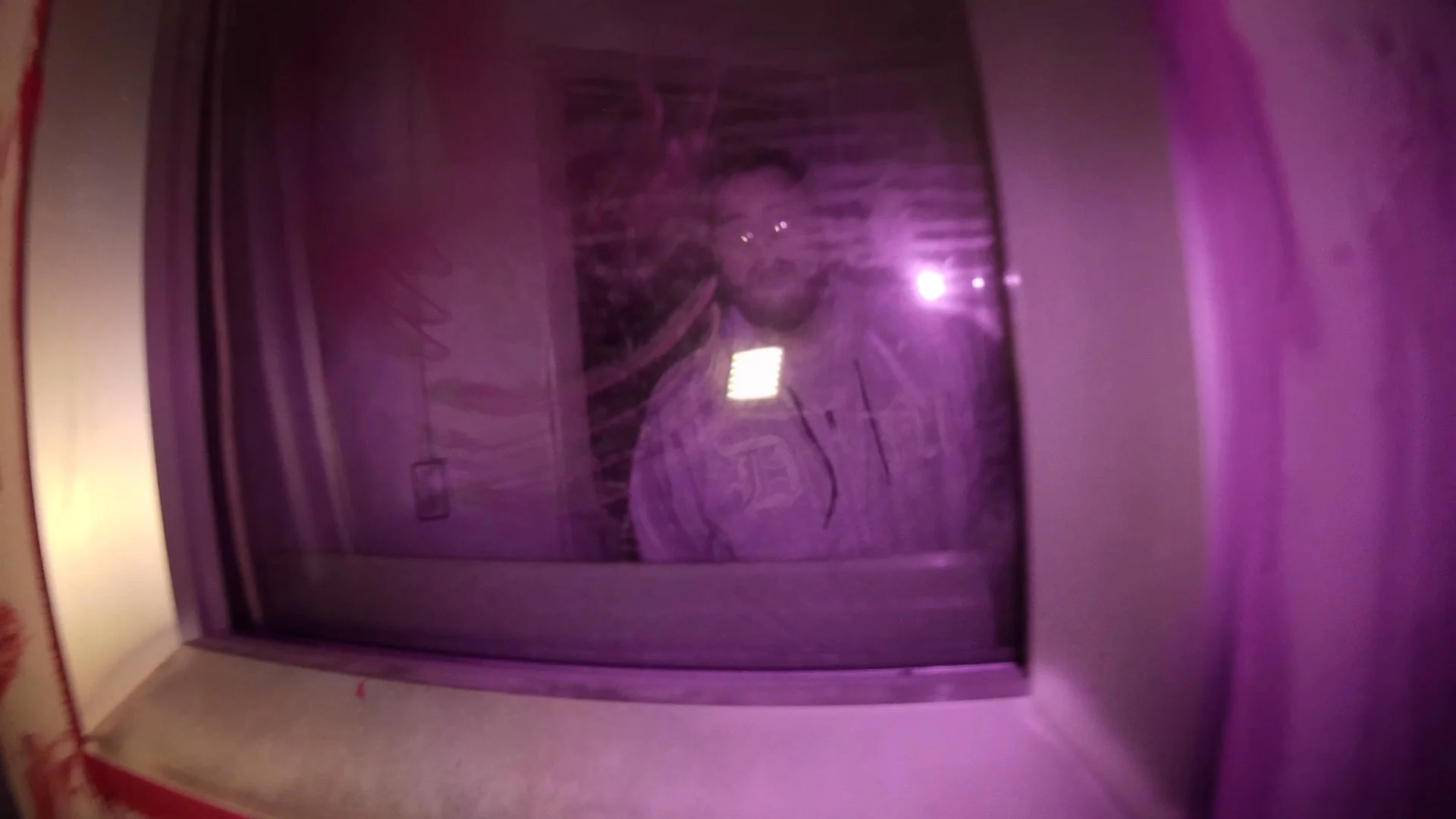 RobbieinXRAY.jpg