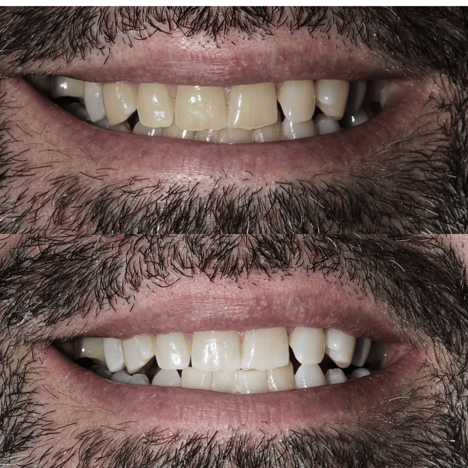 Untitled design (6).png
