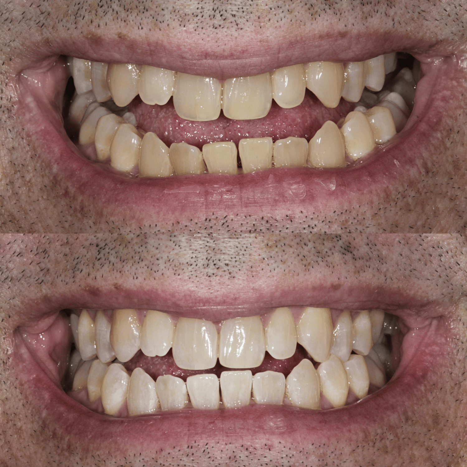 Untitled design (7).png