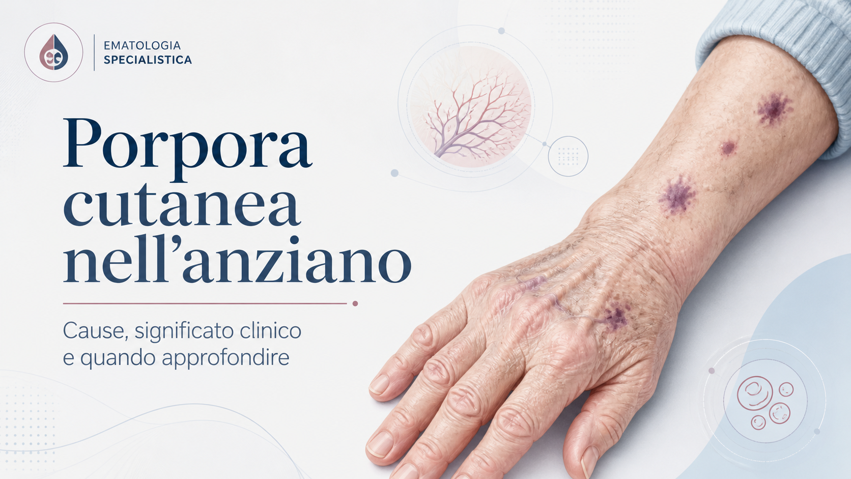 Porpora cutanea nell’anziano: quando è un segno benigno e quando richiede approfondimenti