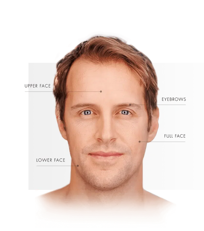 ulthera-homme-zone-visage_en-e1527619694783.png.webp