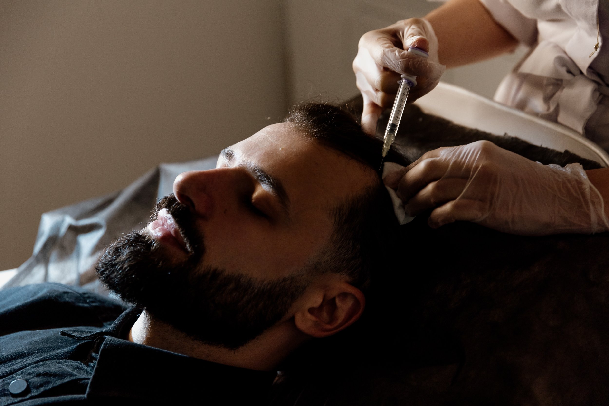 Hair Restoration in Miami: Microneedling, Exosomes, and Collagen Power at Collagen Project