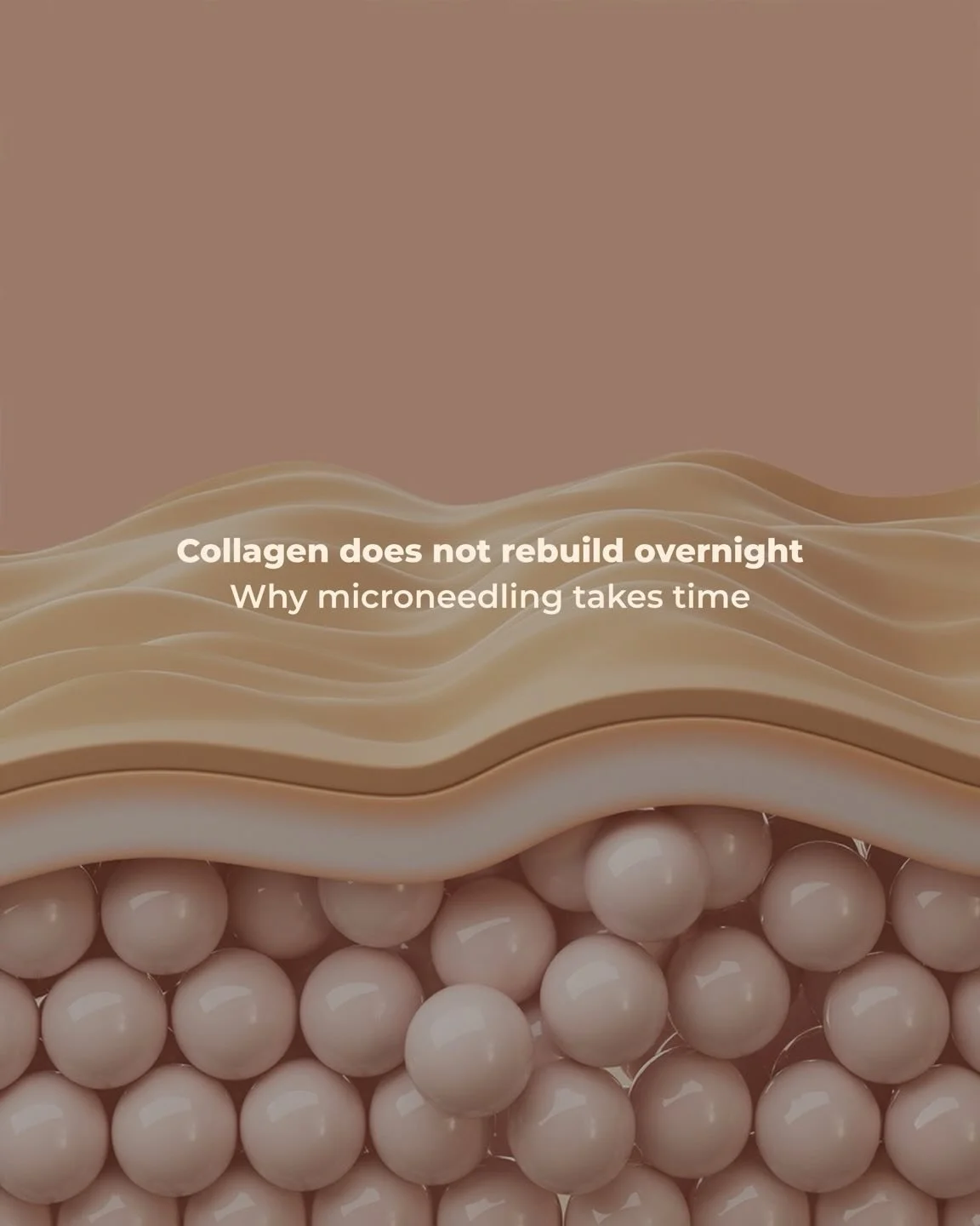 Collagen isn&rsquo;t an overnight build&mdash;it&rsquo;s a biological investment.

Microneedling triggers your body&rsquo;s natural repair response, but collagen production and skin remodeling happen on a cellular timeline, not a social-media one. Ne