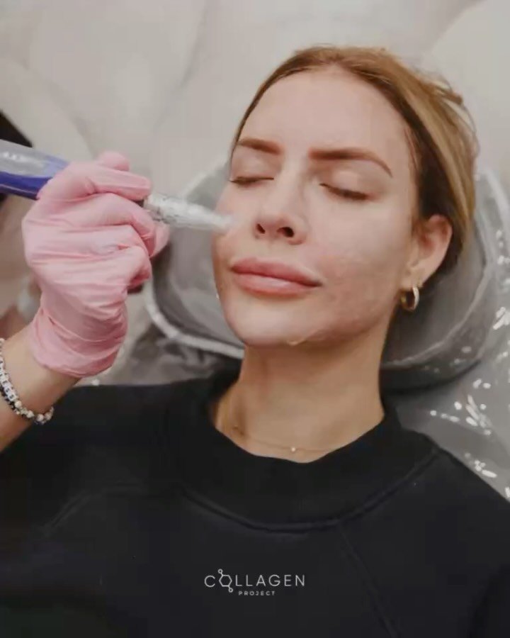 What&rsquo;s your skin goal? ✨

Clear + confident skin starts with knowing what you&rsquo;re treating 👇

&bull; Prevention (hello collagen + aging gracefully)
&bull; Treatment (targeting lines, laxity, acne, scarring)
&bull; Unwanted pigment (sun sp