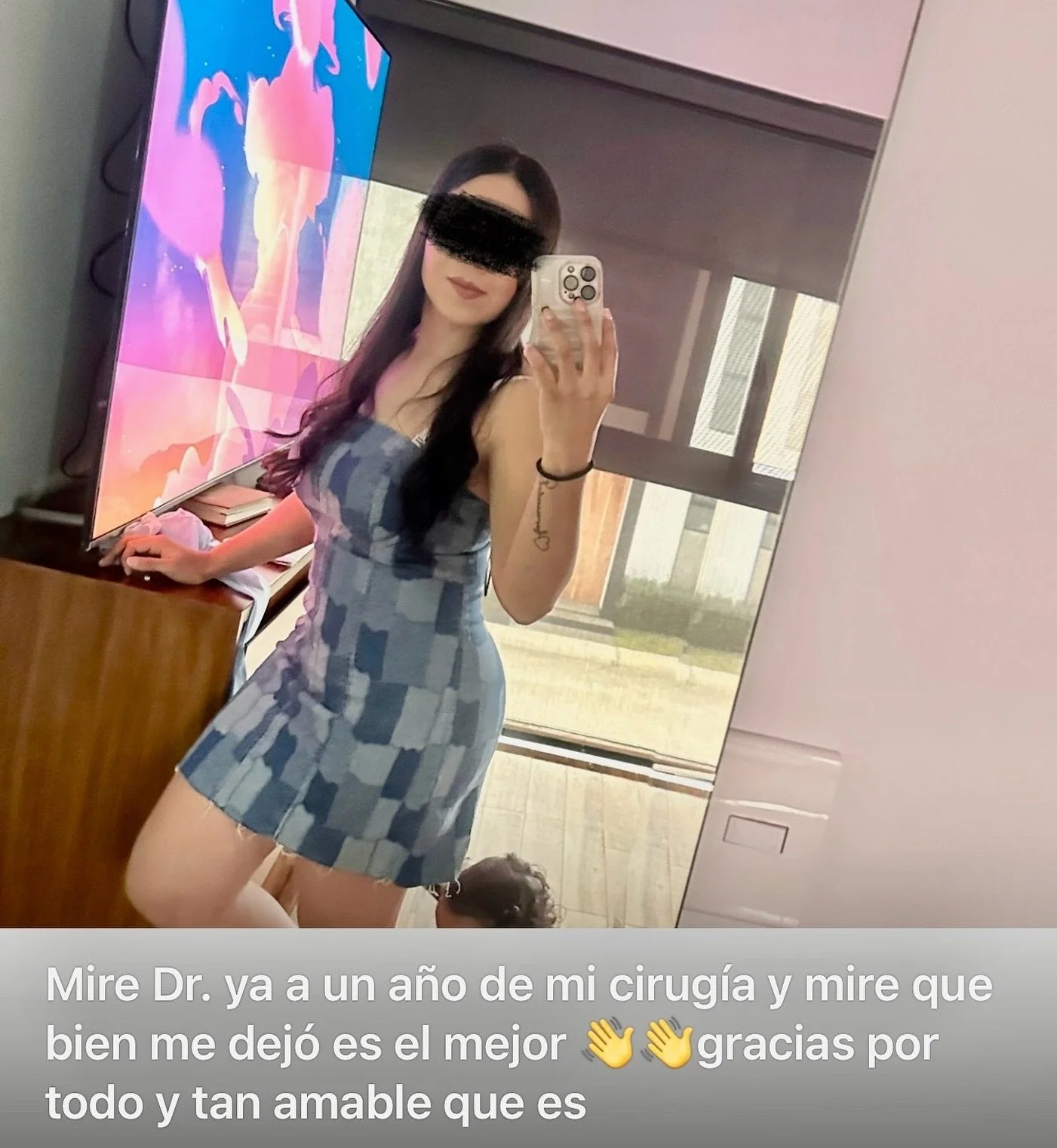 Les comparto el resultado a mediano plazo de una paciente que est&aacute; muy contenta con su cirug&iacute;a de abdominoplast&iacute;a con Lipoescultura + infiltraci&oacute;n de grasa en gl&uacute;teos. 

Les deseo un tranquilo fin de mes, feliz fin 