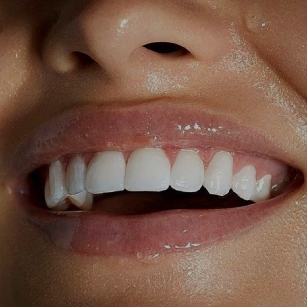 Close-up of a person's smiling mouth, showing bright, white teeth, representative of the expertise of the professional teeth whitening services at The Lab Skin Science.
