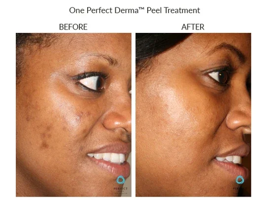 Perfectderma BA Nostalgia Richfield.webp