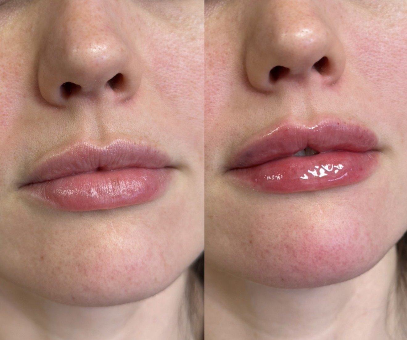 Close-up of a woman's lips before and after applying clear gloss, showing enhanced shine and fuller appearance.