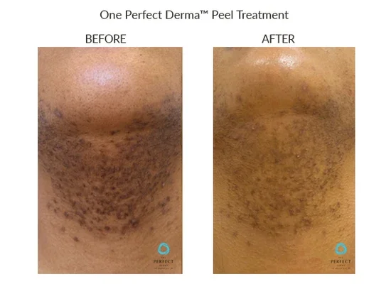 Before_After-Website-31_85fc5586-ae65-4e5a-b2fa-9950f9f2c263_550x.webp