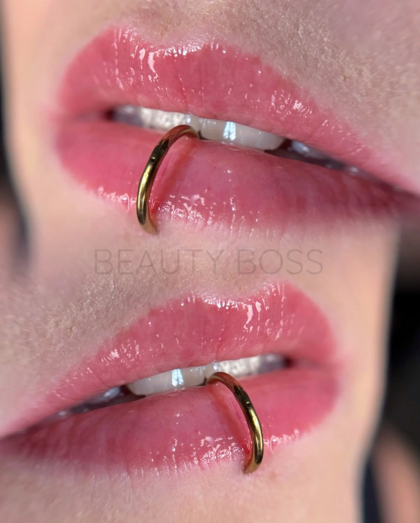 Die richtige Pigmentierung &uuml;berstrahlt nicht, sie unterstreicht 🤌
So wie hier: sanft verheilt, perfekt verblendet &amp; harmonisch mit dem eigenen Hautton✨

Der Farbton Baby Pink ist einer meiner Favoriten 😍 dezent, elegant &amp; ideal f&uuml;