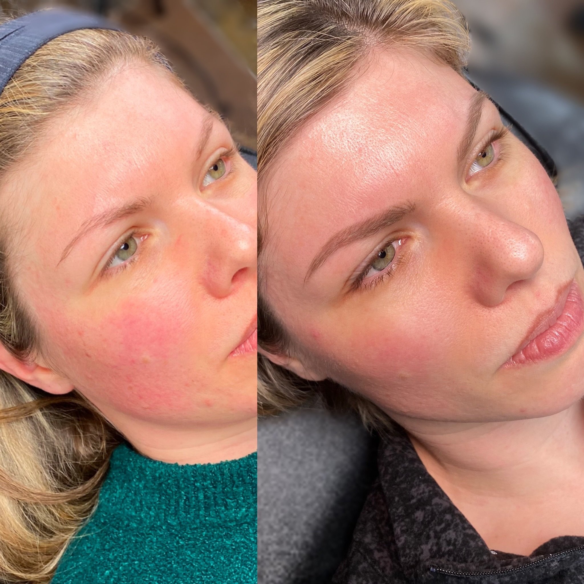 Facetune_25-02-2025-01-46-32.jpeg